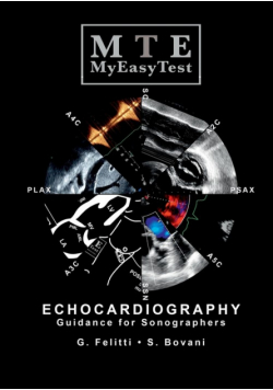 Echocardiography - MyEasyTest