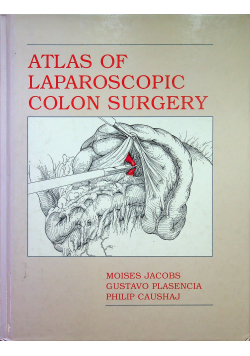 Atlas of laparoscopic colon surgery