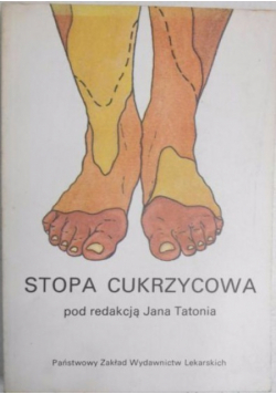 Stopa cukrzycowa