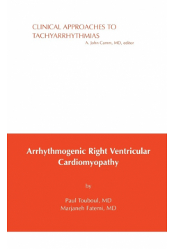Arrhythmogenic Right Ventricular