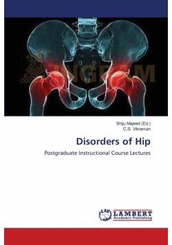 Disorders of Hip