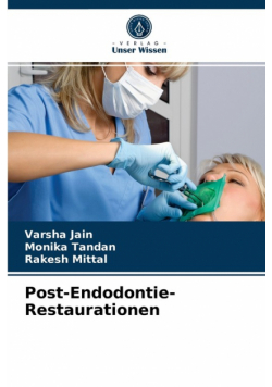 Post-Endodontie-Restaurationen