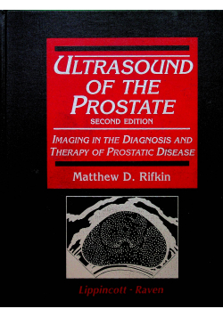 Ultrasound of the prostate