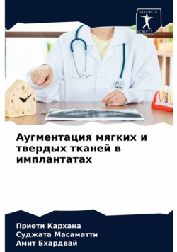 Аугментация мягких и твердых тканей в имплантатах