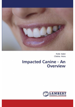 Impacted Canine - An Overview