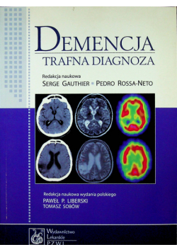 Demencja