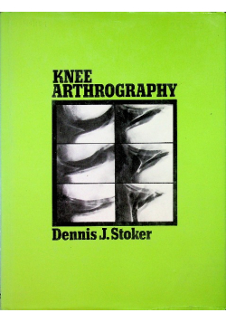 Knee Arthrography