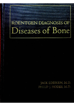 Roentgen diagnose of Diseases of Bones