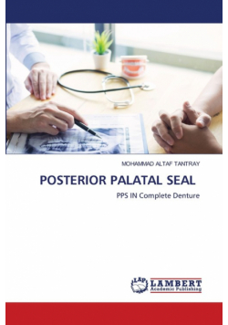 Posterior Palatal Seal
