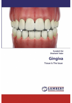 Gingiva