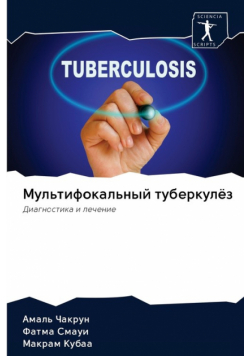 Мультифокальный туберкулёз