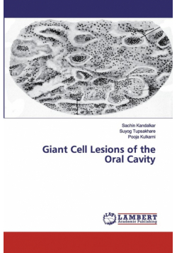 Giant Cell Lesions of the Oral Cavity