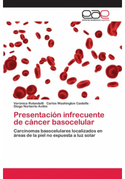 Presentación infrecuente de cáncer basocelular