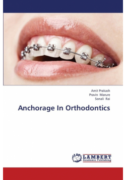 Anchorage in Orthodontics