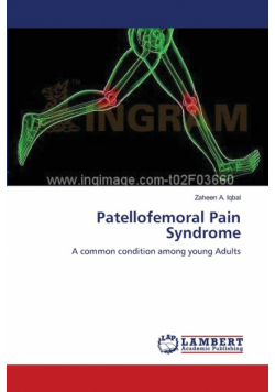 Patellofemoral Pain Syndrome
