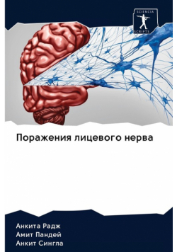 Поражения лицевого нерва