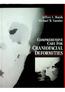 Comprehensive care for craniofacial deformities
