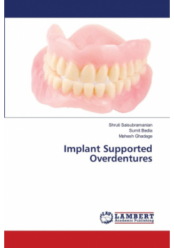 Implant Supported Overdentures