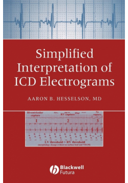 Simplified Interpretation Electrograms