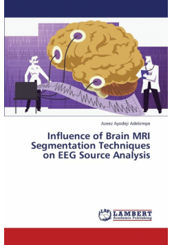 Influence of Brain MRI Segmentation Techniques on Eeg Source Analysis
