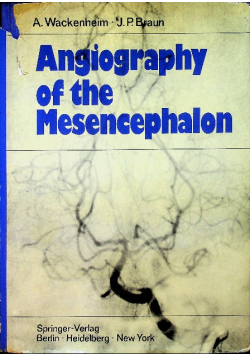 Angiography of the mesencephalon