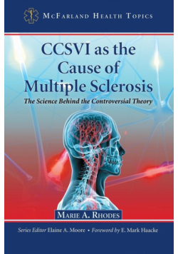 CCSVI as the Cause of Multiple Sclerosis