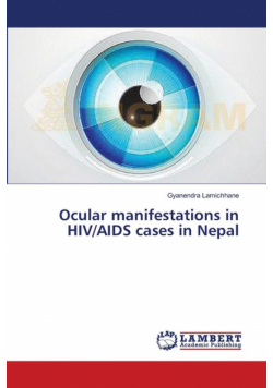 Ocular manifestations in HIV/AIDS cases in Nepal