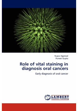 Role of vital staining in diagnosis oral cancers