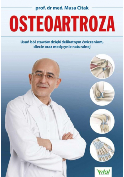 Osteoartroza.