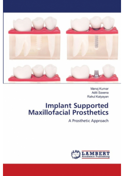 Implant Supported Maxillofacial Prosthetics