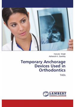 Temporary Anchorage Devices Used in Orthodontics