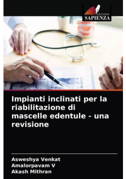 Impianti inclinati per la riabilitazione di mascelle edentule - una revisione