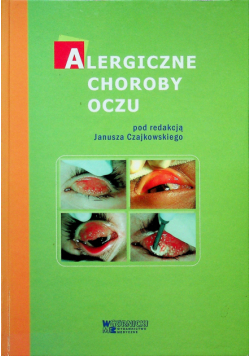 Alergiczne choroby oczu