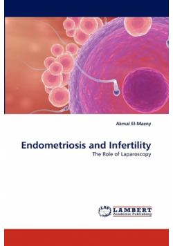 Endometriosis and Infertility