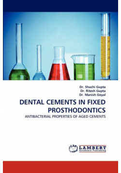 Dental Cements in Fixed Prosthodontics