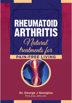 Rheumatoid Arthritis