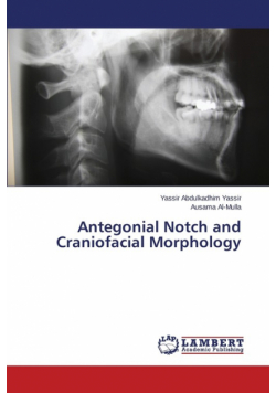 Antegonial Notch and Craniofacial Morphology