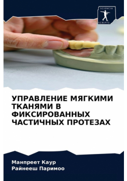 УПРАВЛЕНИЕ МЯГКИМИ ТКАНЯМИ В ФИКСИРОВАННЫХ ЧАСТИЧНЫХ ПРОТЕЗАХ