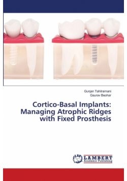 Cortico-Basal Implants