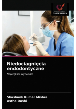 Niedociągnięcia endodontyczne