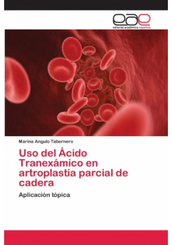 Uso del Ácido Tranexámico en artroplastia parcial de cadera