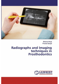 Radiographs and Imaging techniques in Prosthodontics