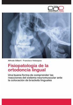 Fisiopatología de la ortodoncia lingual