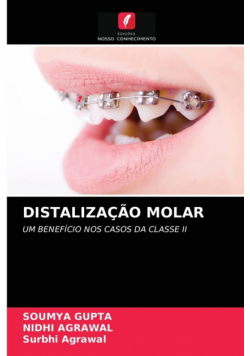 Distalização Molar