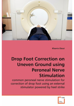 Drop Foot Correction on Uneven Ground using Peroneal Nerve Stimulation