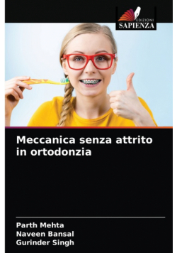 Meccanica senza attrito in ortodonzia