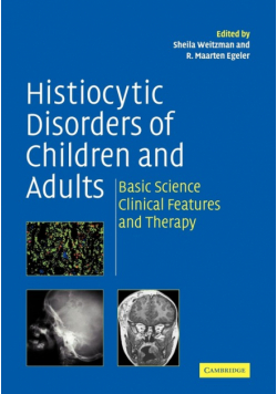 Histiocytic Disorders of Children and Adults