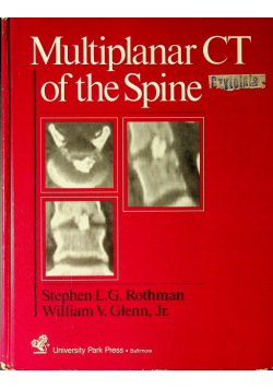 Multiplanar CT of the Spine