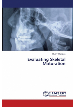 Evaluating Skeletal Maturation