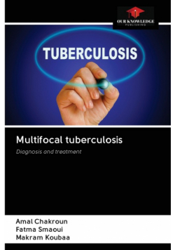 Multifocal tuberculosis